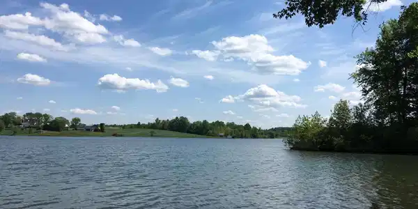 00 LAKE FOREST DR